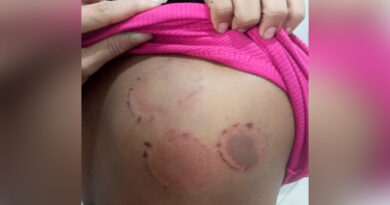 Homem é preso em flagrante após agredir a namorada com socos e mordidas em Pinheiro