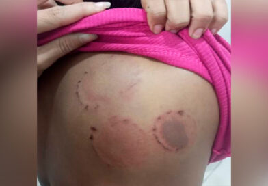 Homem é preso em flagrante após agredir a namorada com socos e mordidas em Pinheiro