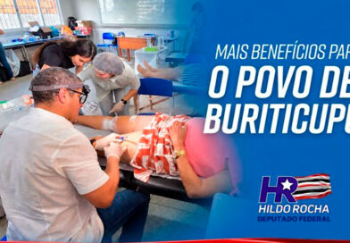 Mutirão de tratamento de varizes foi realizado em Buriticupu, graças a emenda do deputado Hildo Rocha