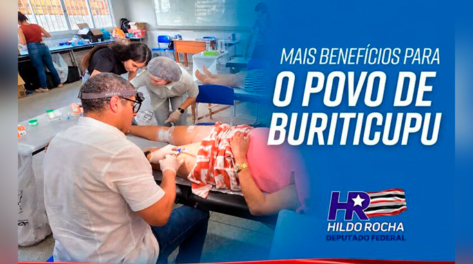 Mutirão de tratamento de varizes foi realizado em Buriticupu, graças a emenda do deputado Hildo Rocha